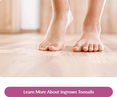 learn more about ingrown toenails